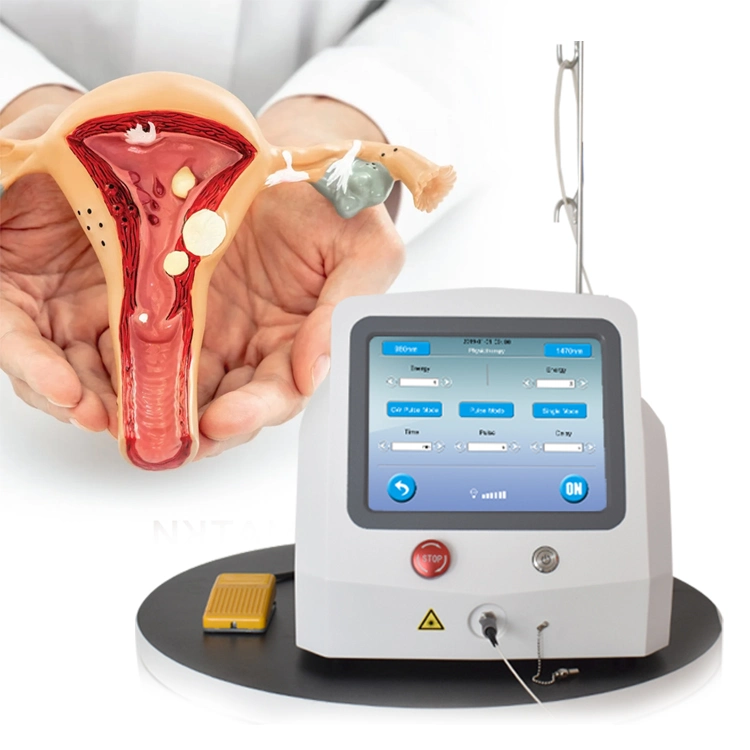 Système laser portable de chirurgie de rajeunissement et de tension vaginal 980nm 1470nm Laser à diode