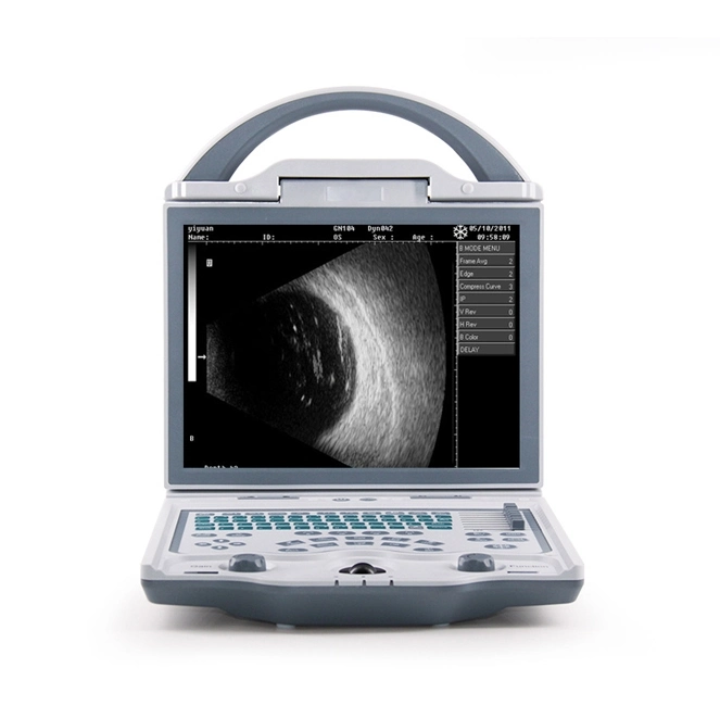 Portable Biometry Accuracy Full Digital Ophthalmic a/B Ultrasound Scanner