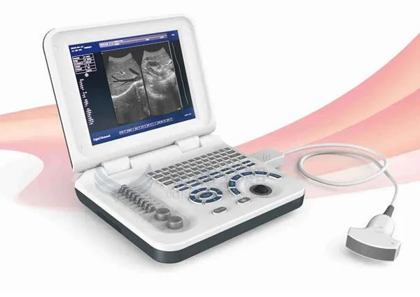 Black and White 10 Inch Tabe Top LED Ultrasound Scanner