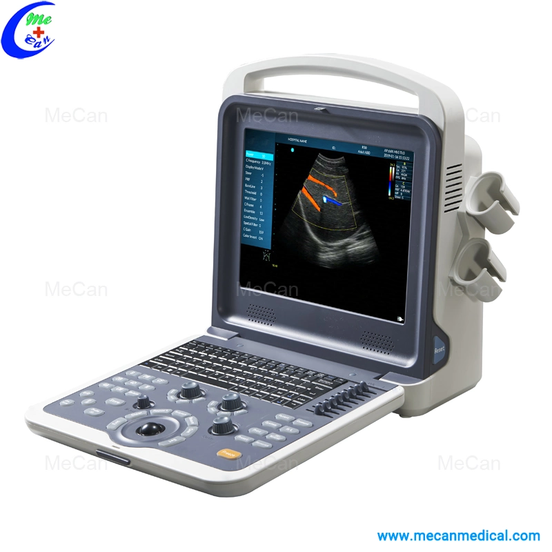 Most Cost-Effective Portable Color Doppler Ultrasound Scanner/Ultrasound Machine