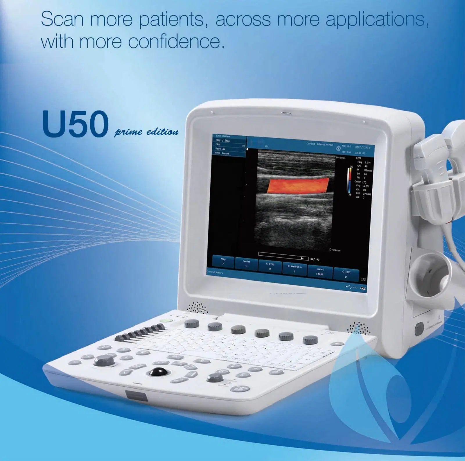 Edan U50 12.1 Inch Portable Color Doppler Ultrasound