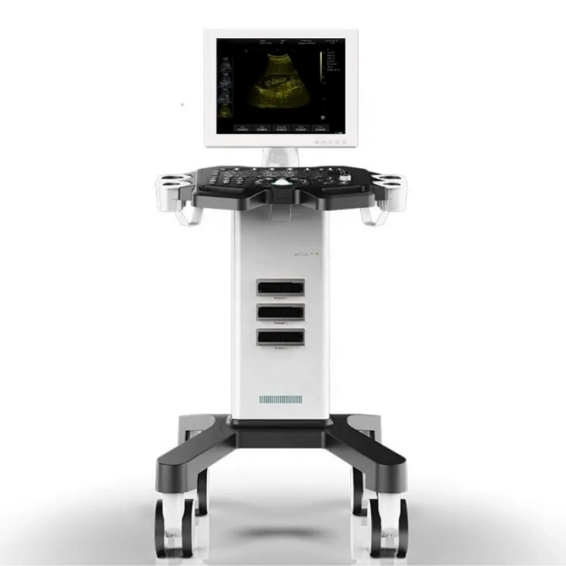 Trolley Black and White Ultrasound Scanner Machine Ultrasonic Diagnostic System