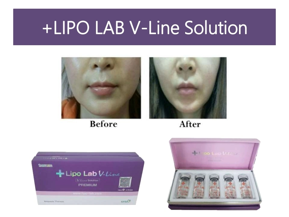 Precio mayorista Lipo Lab V-Line solución para pérdida de cuerpo facial Peso producto Liposis Slimming Injection Lipo Lab Lemonbottle Ampoule Kybella