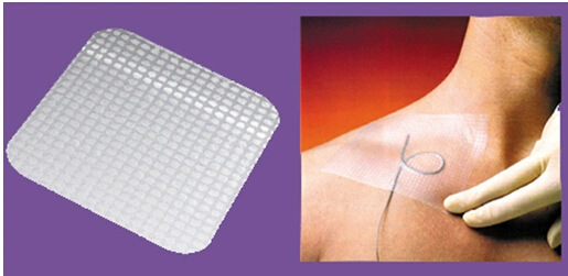 High-Permeable Grid Coating Wound Dressing with Ce and ISO