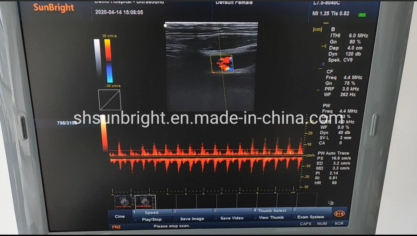 Two Probe Connectors 3D/4D Color Doppler Machine Prengnancy Color Doppler