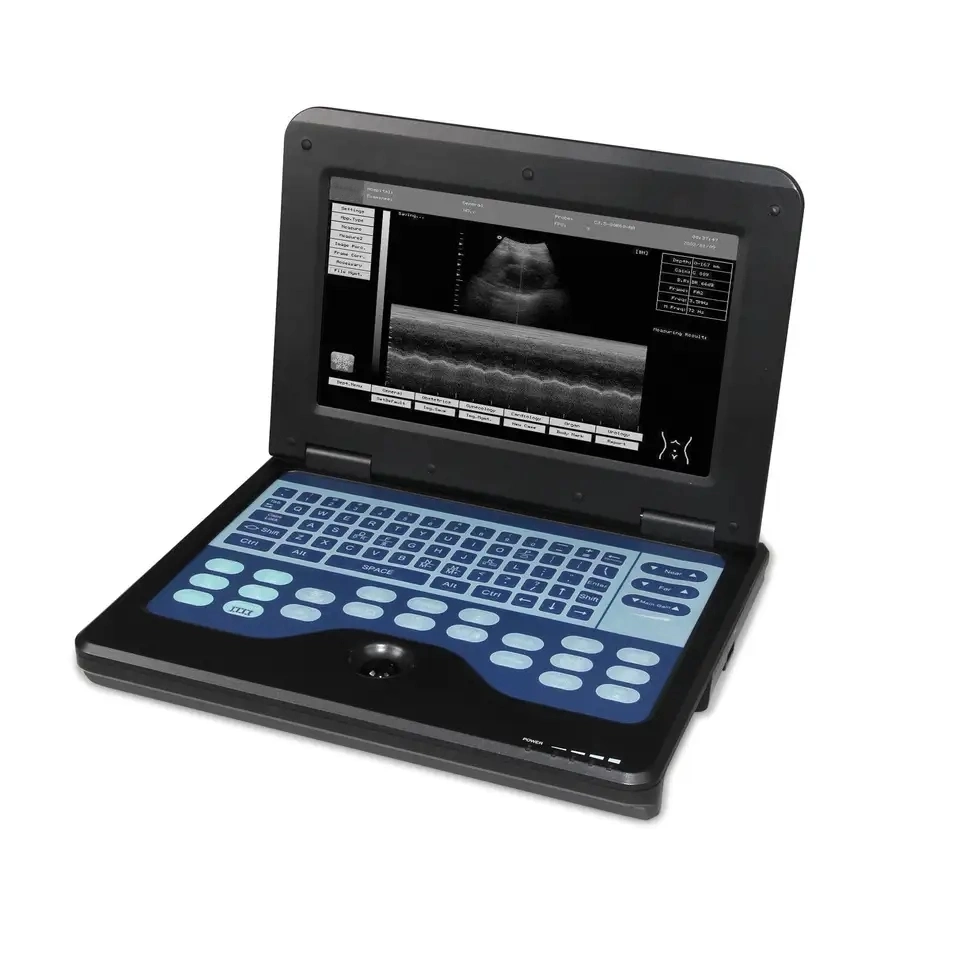 CE Approved Laptop Portable Digital B Ultrasound Diagnostic System Ultrasound Machine