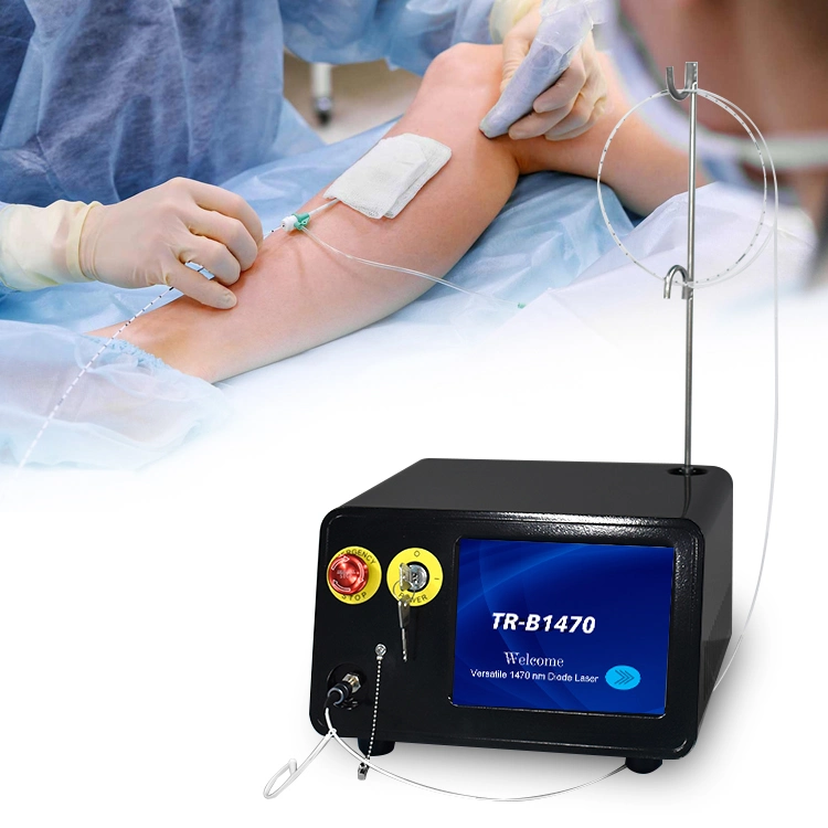 Flebologia Phlebology Laser 1470nm Evla Vascular Surgery Laser Ablation Varicose Veins Evlt Laser Endovenous Machine