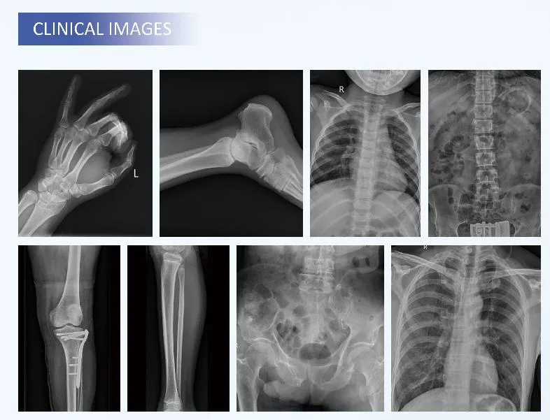 Hospital Digital X-ray Machine, Mobile Dr (DP326B-2)