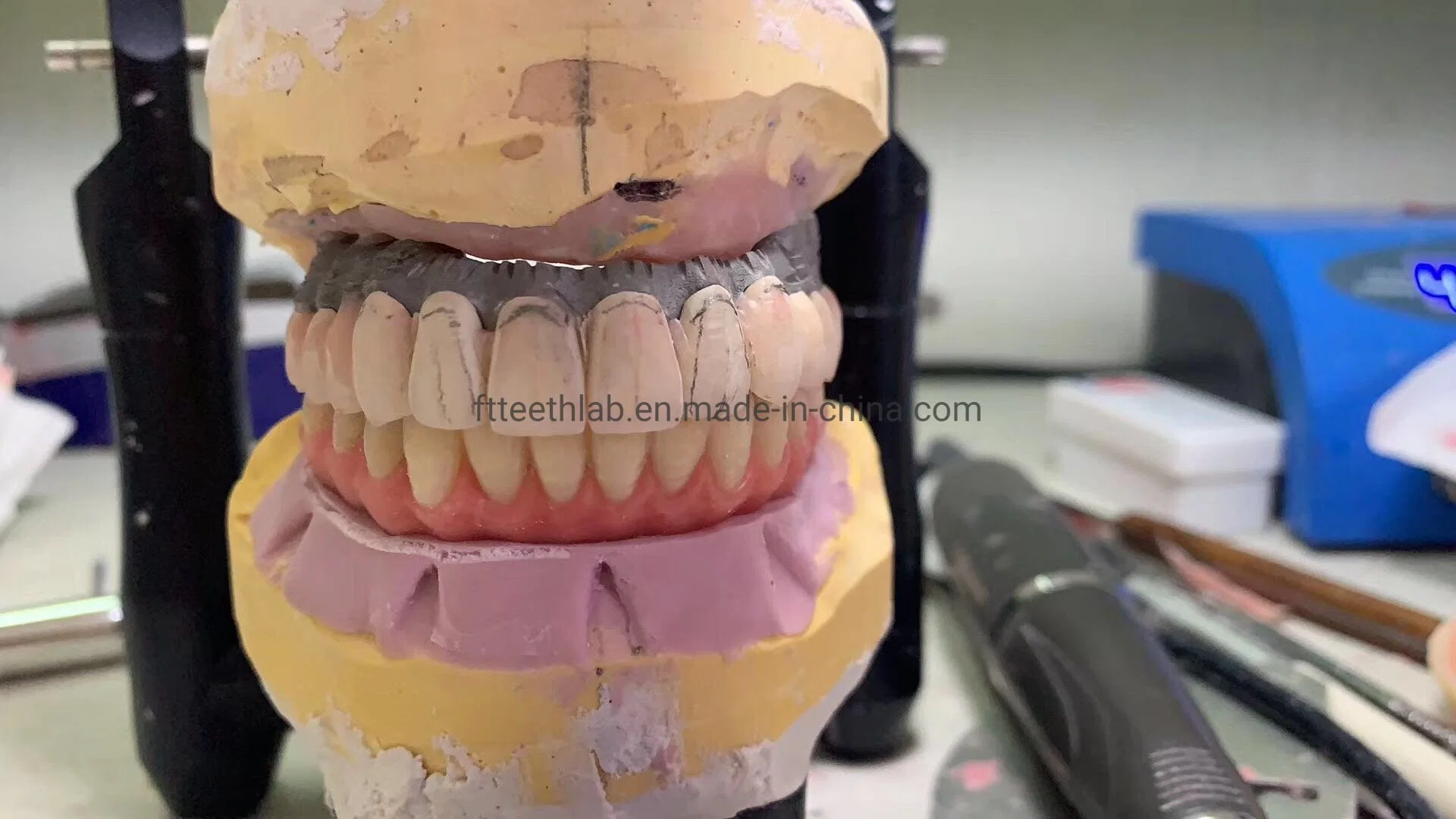 Full Arch Layered Zirconia Implant Bridge Dental Implants