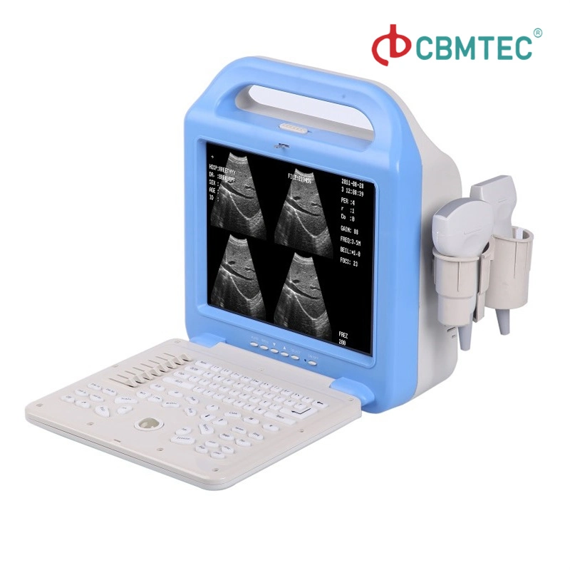 Hot Sale 10 Inches SVGA Ultrasound Scanner with Probes