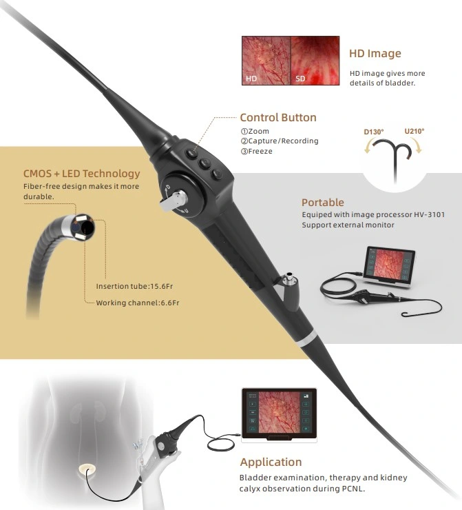 LTEF24B Hospital HD Image Bladder Kidney Examination Flexible Video Cystonephroscope