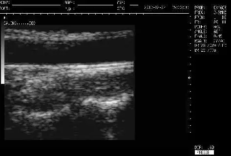 Tragbarer volldigitaler S/W-Ultraschallscanner