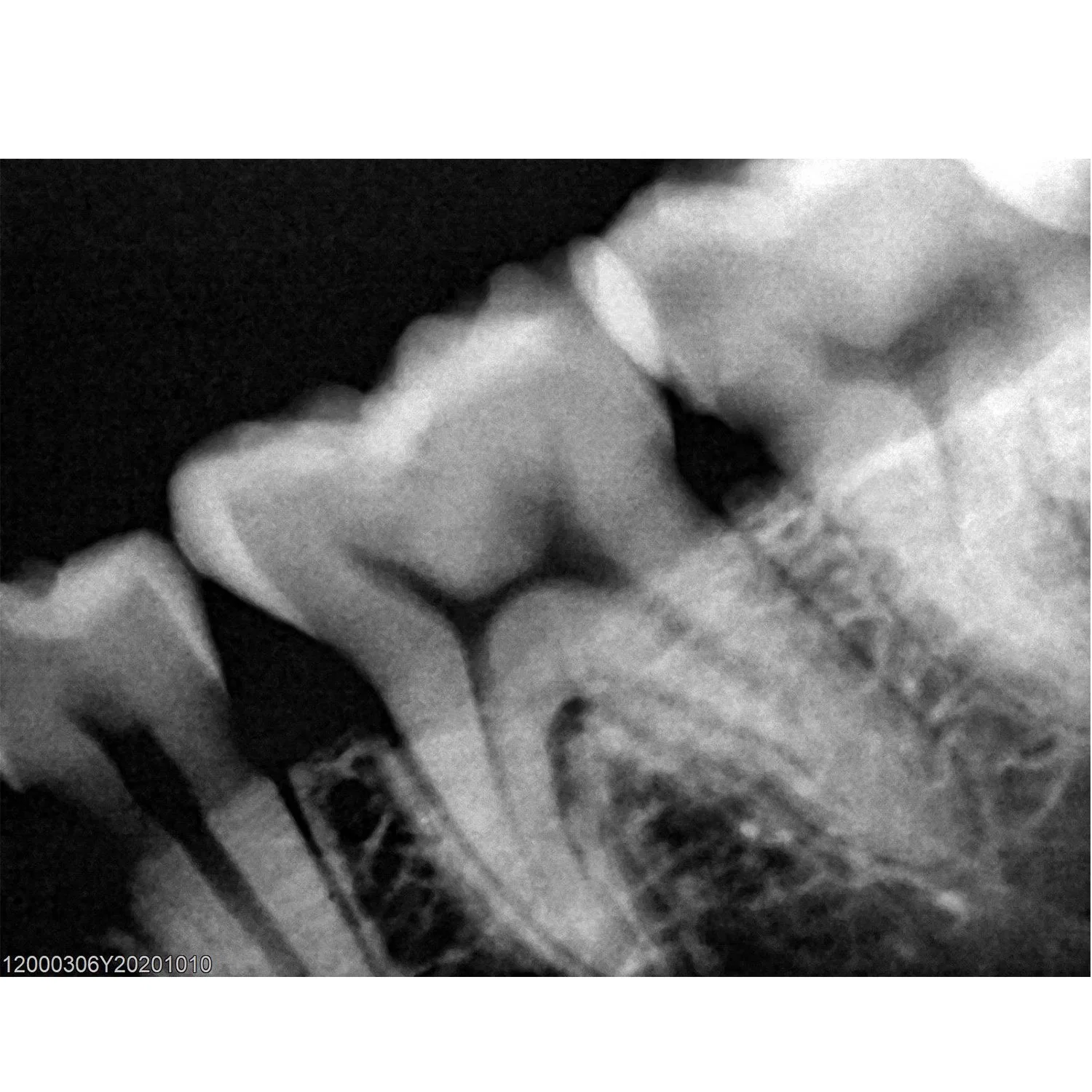 Digital Dental Rvg Sensor, Good Image USB Dental X Ray Sensor Ruyes