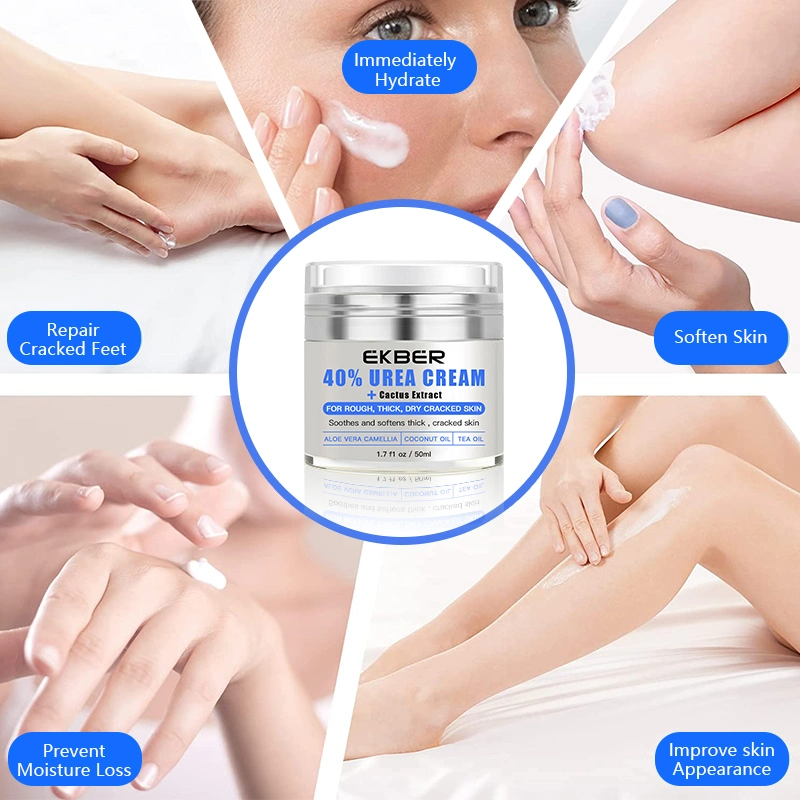 Hot Sale 40% Urea Skin Repair Cream Vitamin E Urea Moisturizing Whitening Cream