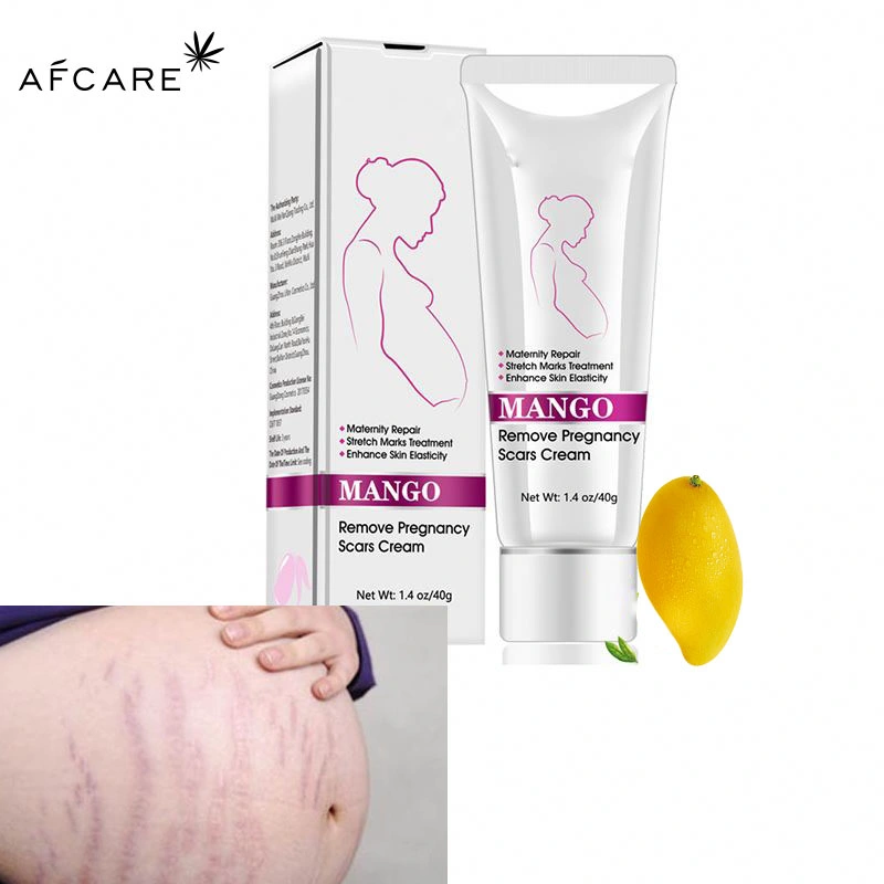 Customized Label Pregnancy Anti-Stretch Mark Removal Repair Cream Best Natural