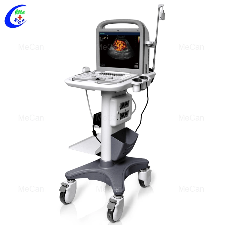 Sonoscape S6 Cardiac 4D Color Doppler Echo Ultrasound Machine with Pw Cw