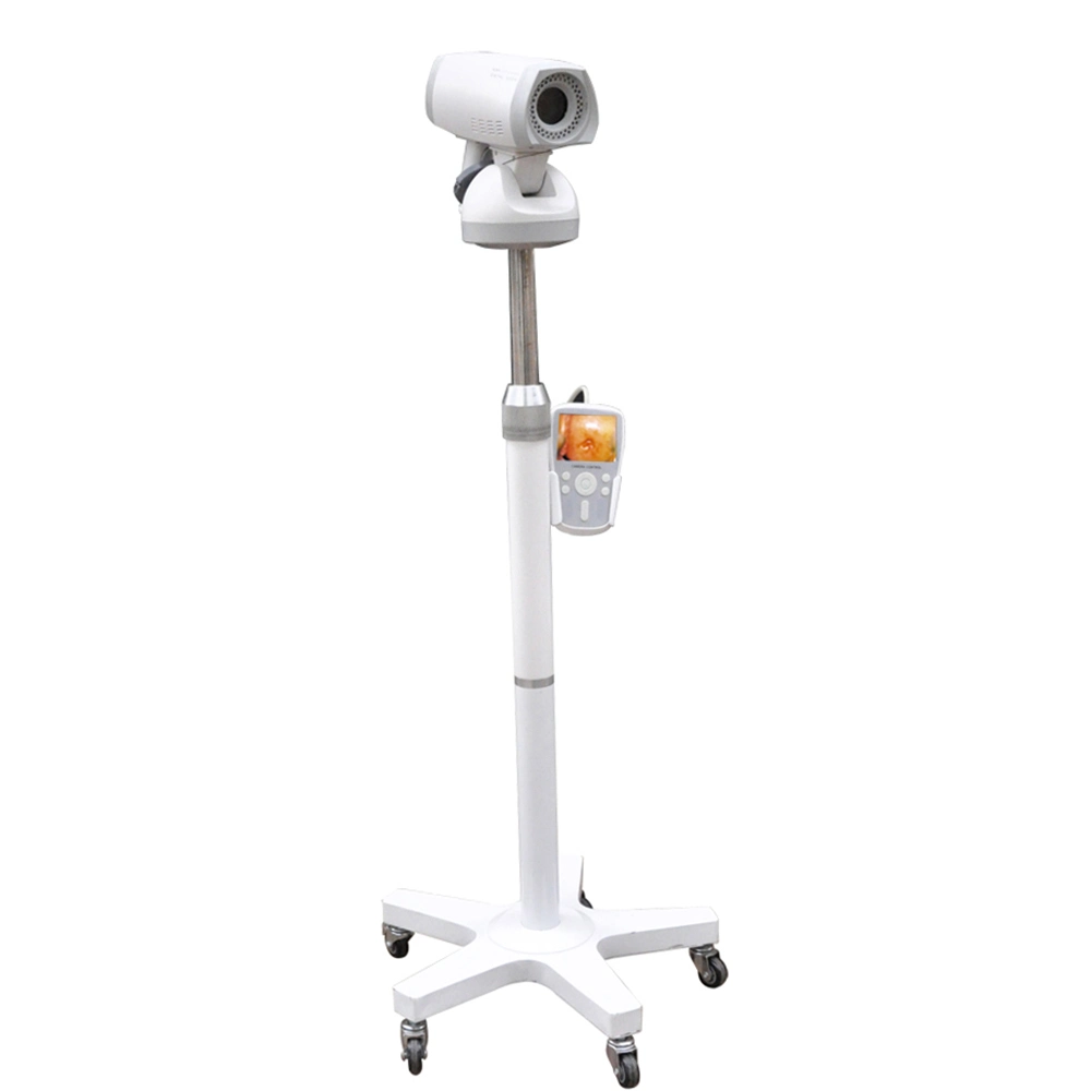 Medical Use Portable Optical Video Colposcope Vaginal Colposcopy Exam Device