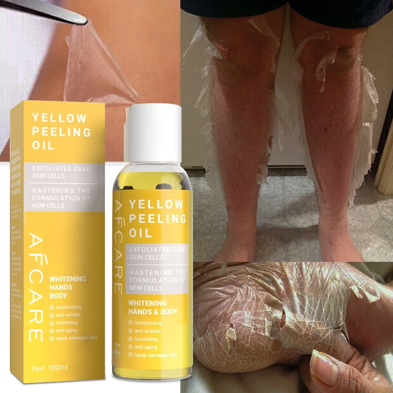 Etiqueta privada más eficaz Whitening piel Amarillo Peeling aceite para Nudillos oscuros