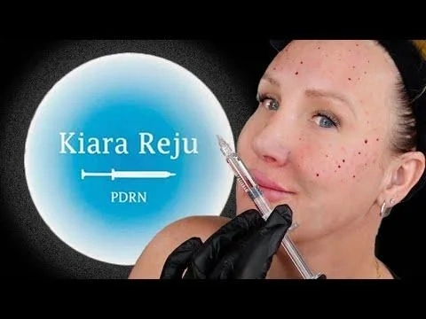 Famous Brand Kiara Reju Skin Boosters Based on Polydeoxyribonucleotide (PDRN) Hyaluronic Acid Ha Niacinamide Well Brings Moisture to The Skin Elasty Hyaron