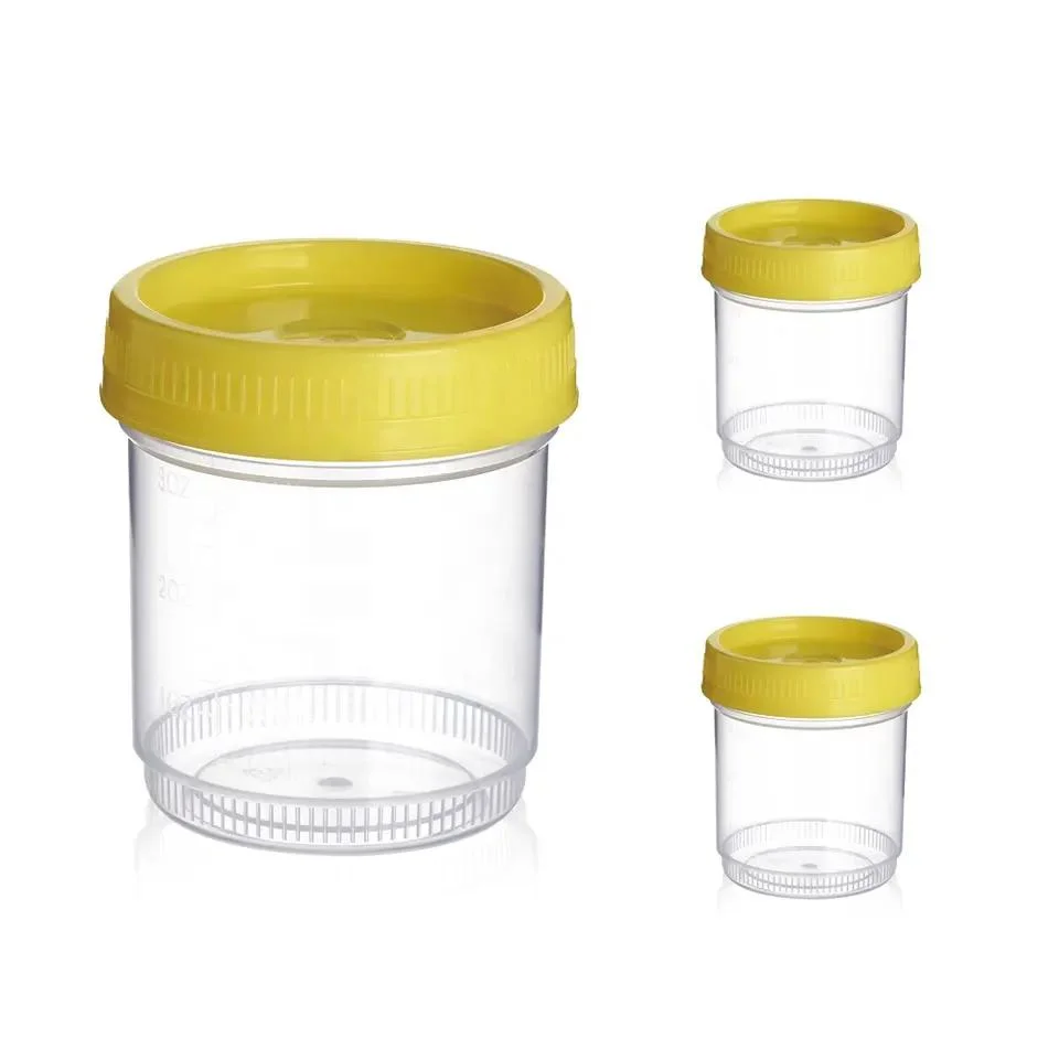 90ml 100ml 120ml Plastic Medical Disposable Graduated Sterile Sampling Specimen Cup Urine Specimen Container with Lid