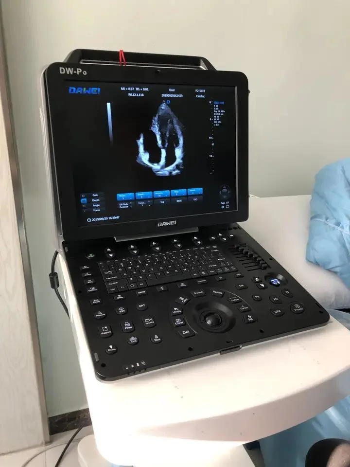 Heart Fy-P8 Portable Dual Ports 3D/4D Ultrasound