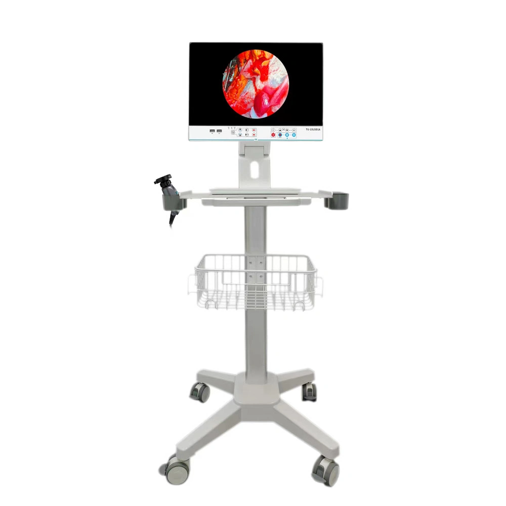 ICEN 1080p 15.6'' Medical Rigid Endoscope Camera Integrated Surgical Led Light Source Monitor Machine