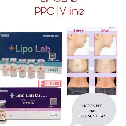 Lipo Lab V linha Premium de solução Ppc Solução Lipolítico Lipólise Lipo-Lab Injecção