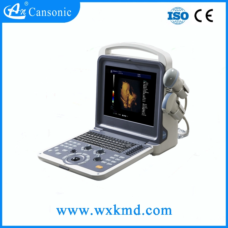 Color Doppler Ultrasound Scanner Similar with Mindray