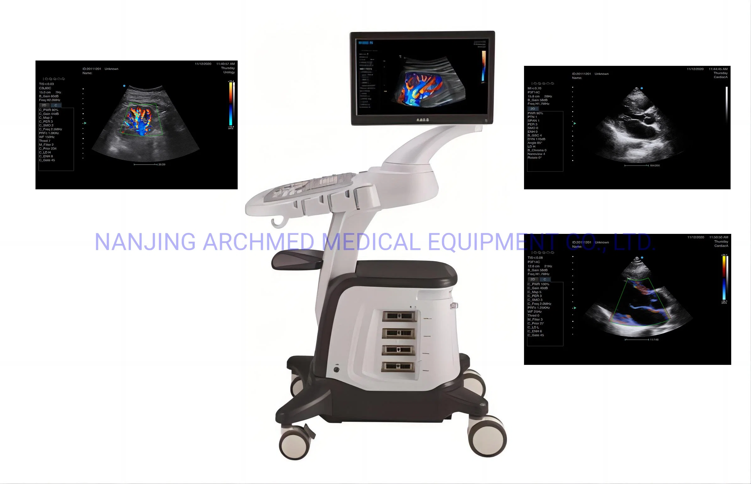 Medizinische Geräte Voll Digital Tragbare Farb-Doppler-Diagnosesystem Ultraschall Scanner-Ultraschallmaschine mit 18,5′ ′ LCD-Monitor