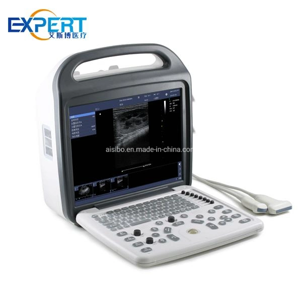 Em-G12 Medical 4D Digital Ultrasound Scanner Portable Medical Ultrasound Machine