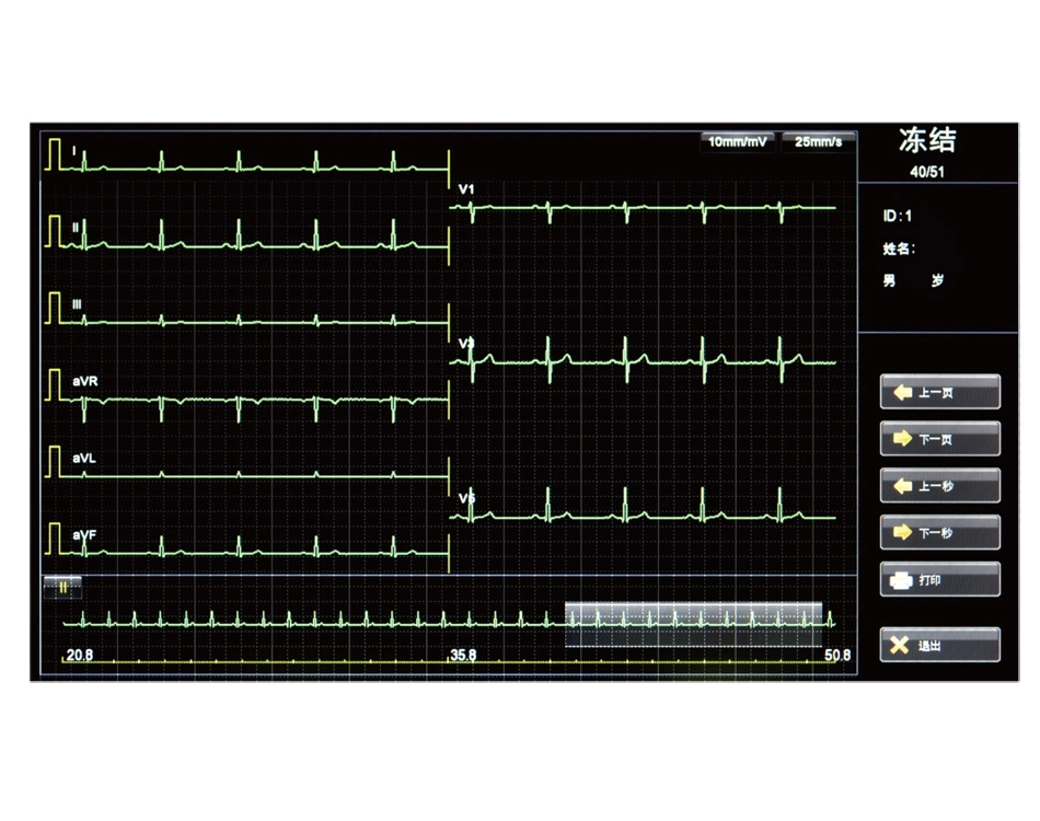 18 Channel ECG Machine Touch Screen ECG Machine digital portable ECG Machine