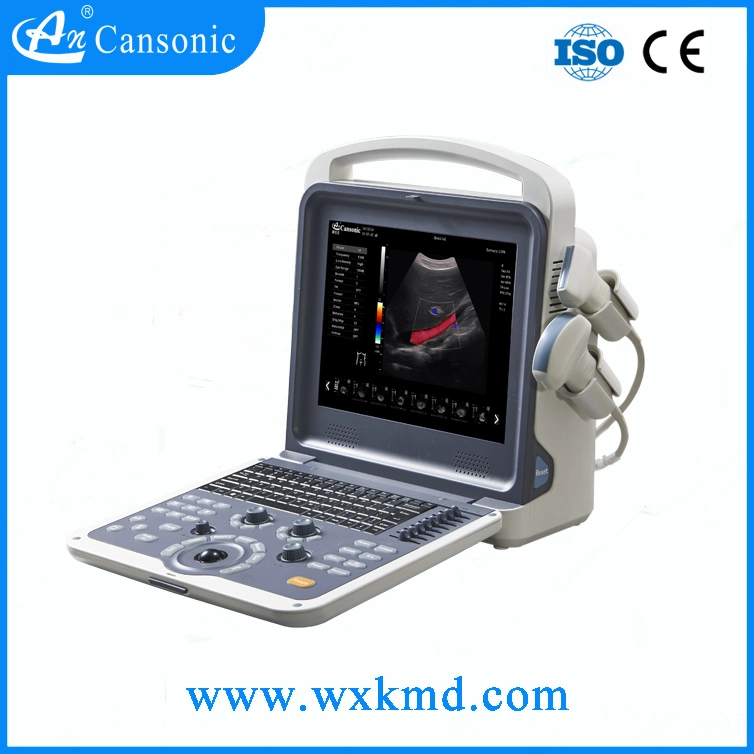 Portable Color Doppler Ultrasound Scanner for Cardiology