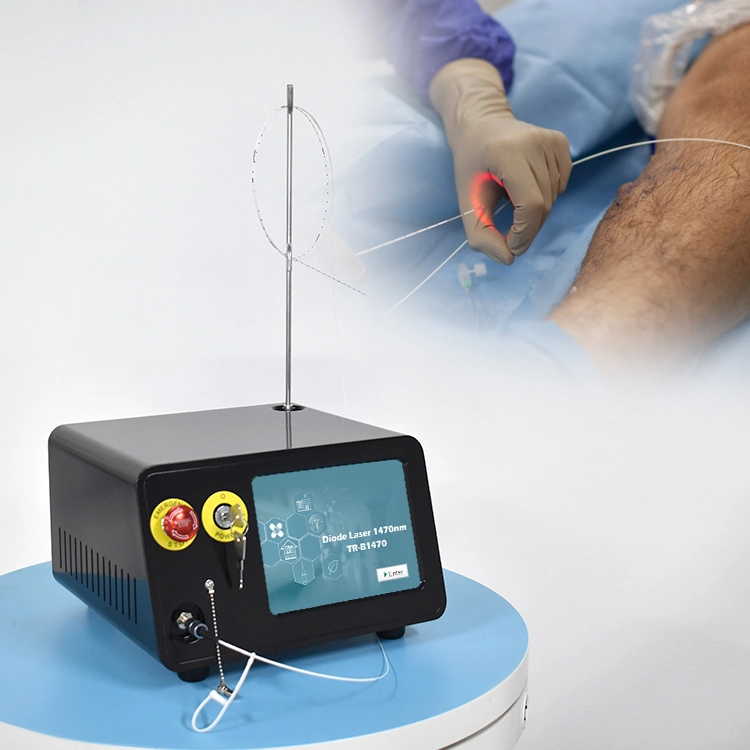 1470nm máquina láser de diodos EVLT/Evla para el tratamiento de vasos sanguíneos Varicous Venas