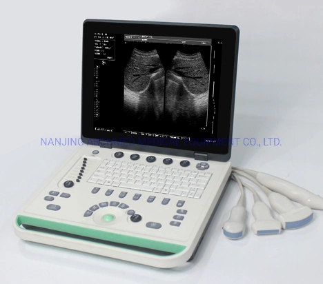 Medical Equipment Laptop Digital Portable Ultrasound Scanner B/W with 15 Inch Medical LED Monitor