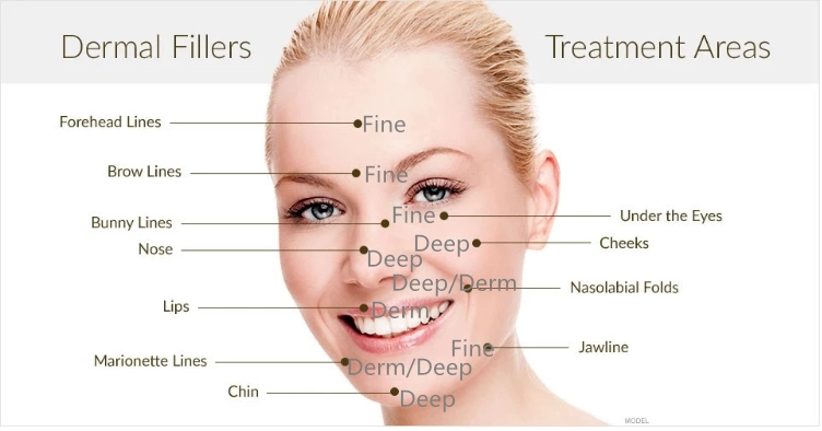 Inquiry About 2ml Hyaluronic Acid Gel Injectable Ha Dermal Filler Lips Enhancement