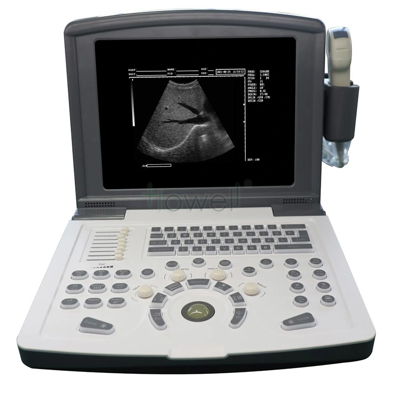 B/W Ultrasound Machine for Liver/ Gallbladder/Pancreas/Spleen Examination