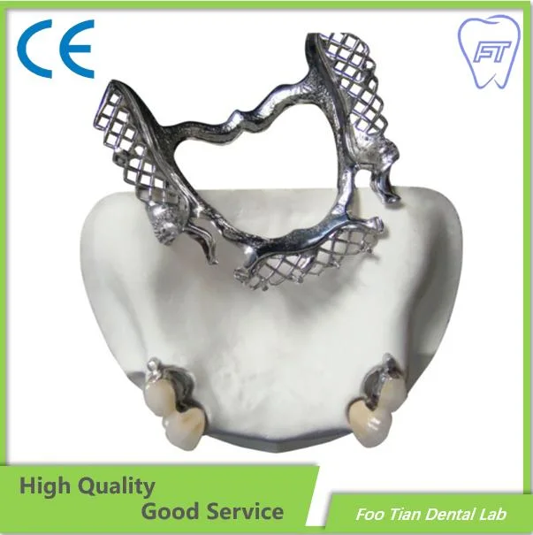 بيع denture Cast Partial Framework Dental مخصص