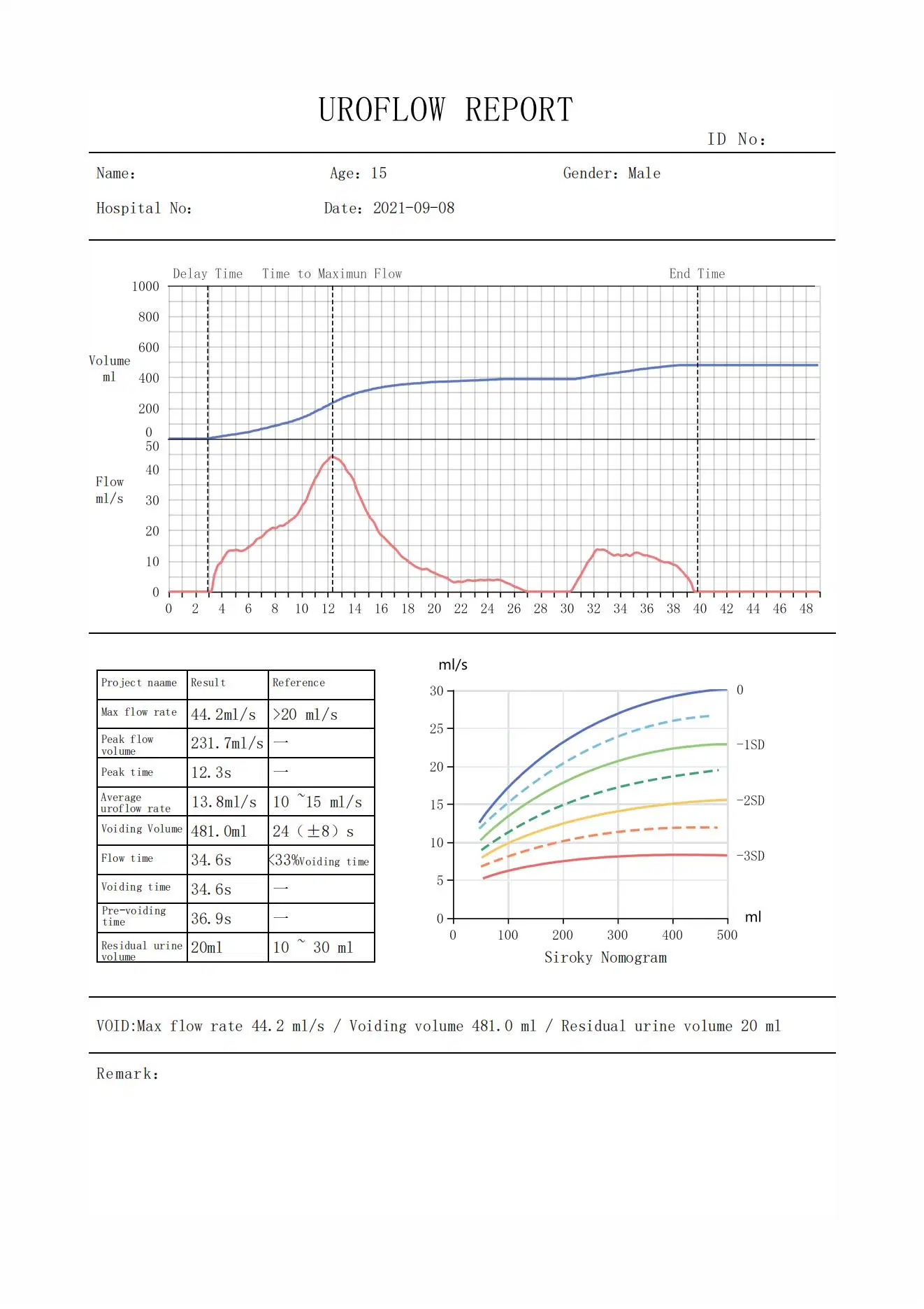 Top Urology Device Companies Manufacturer PC Series1100ml Dantec Uroflowmetry with Normal Urine Flow Rate Graph