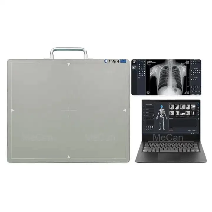 17*17 Dr Medical Veterinary Wireless Digital X-ray Flat Panel Detector with Outstanding Image