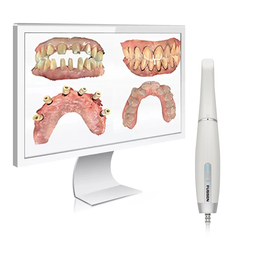 Portable Efficient Mini Dental Intraoral Oral Scanner 3D Digital Imaging for Dental