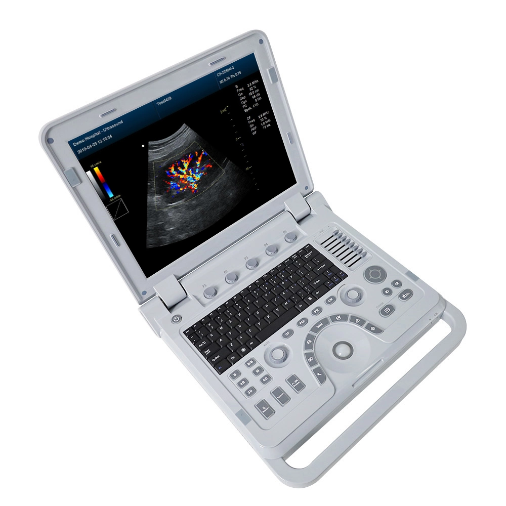 Electric Contec China Color Doppler Machine Ultrasonic Medical Equipment Portable Scanner Ultrasound Transducer