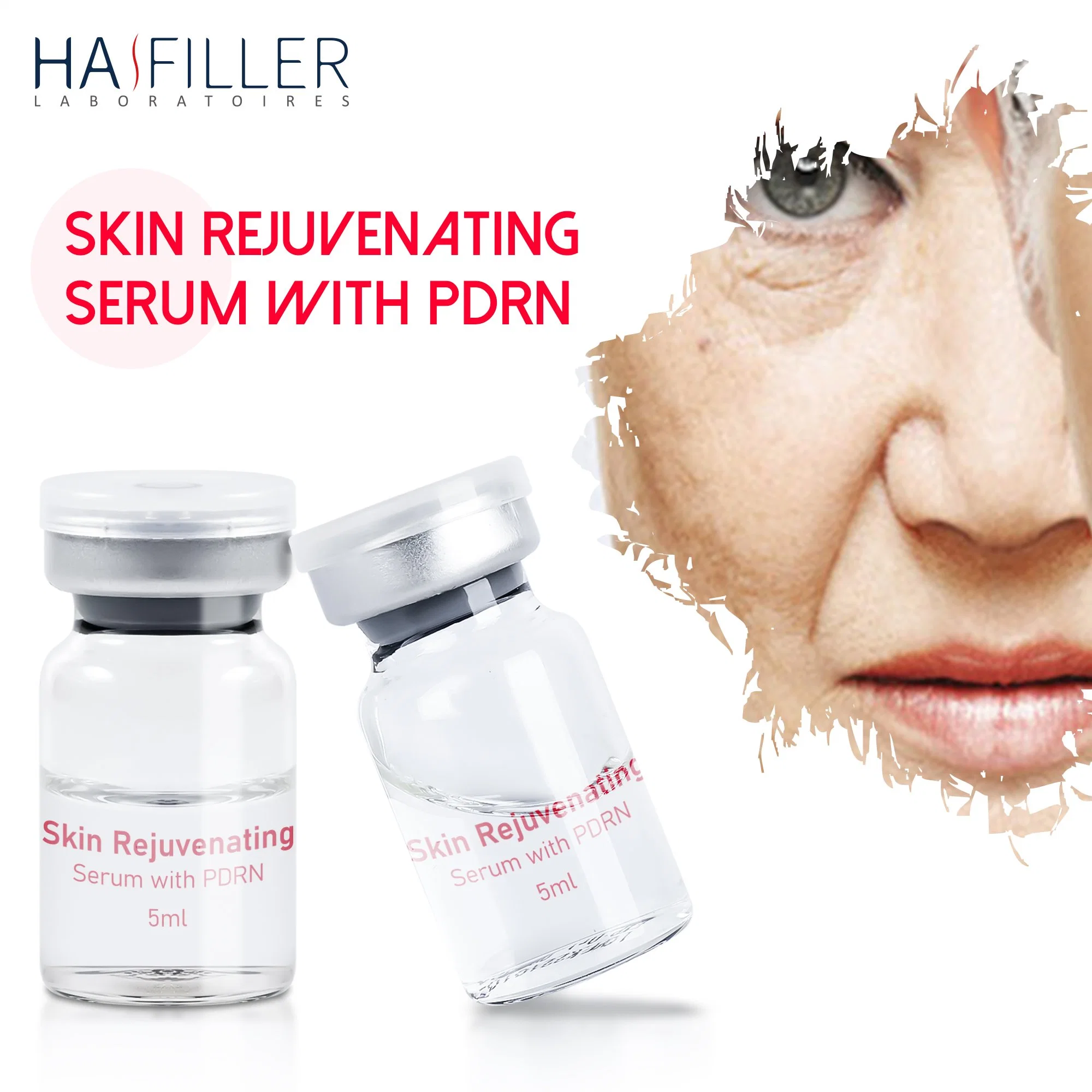 High quality/High cost performance Repair Skin Sun Damage Skin Rejuvenating Serum Pdrn Injection Mesotherapy Serum