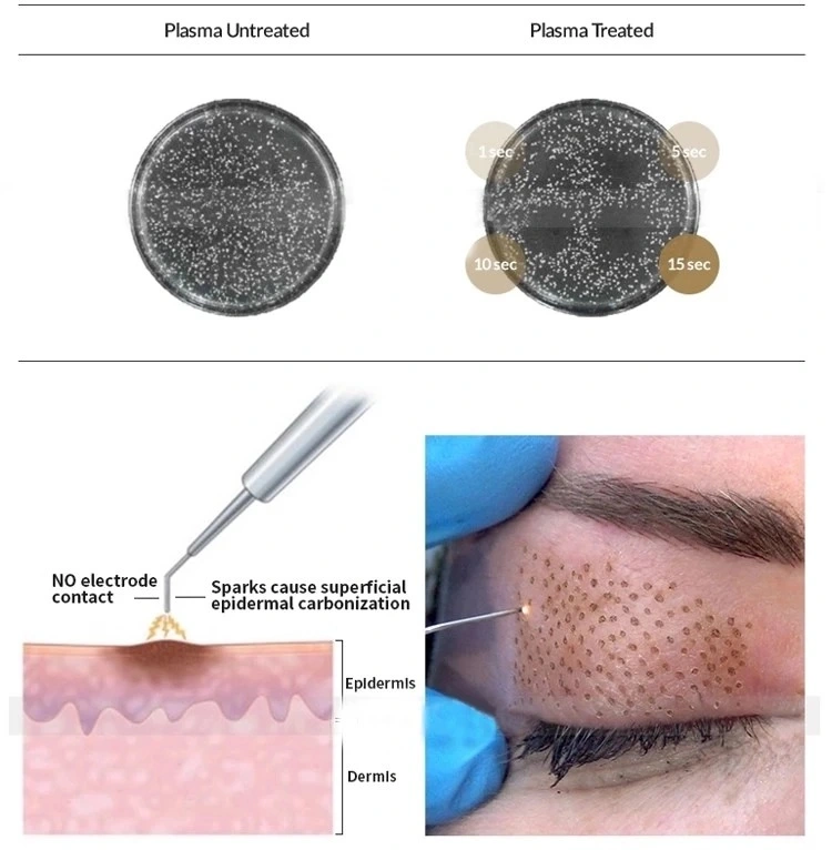 2019 Pluma Plasma la regeneración de piel de cara el tratamiento y eliminación de acné Blanqueamiento de la piel de equipos de belleza