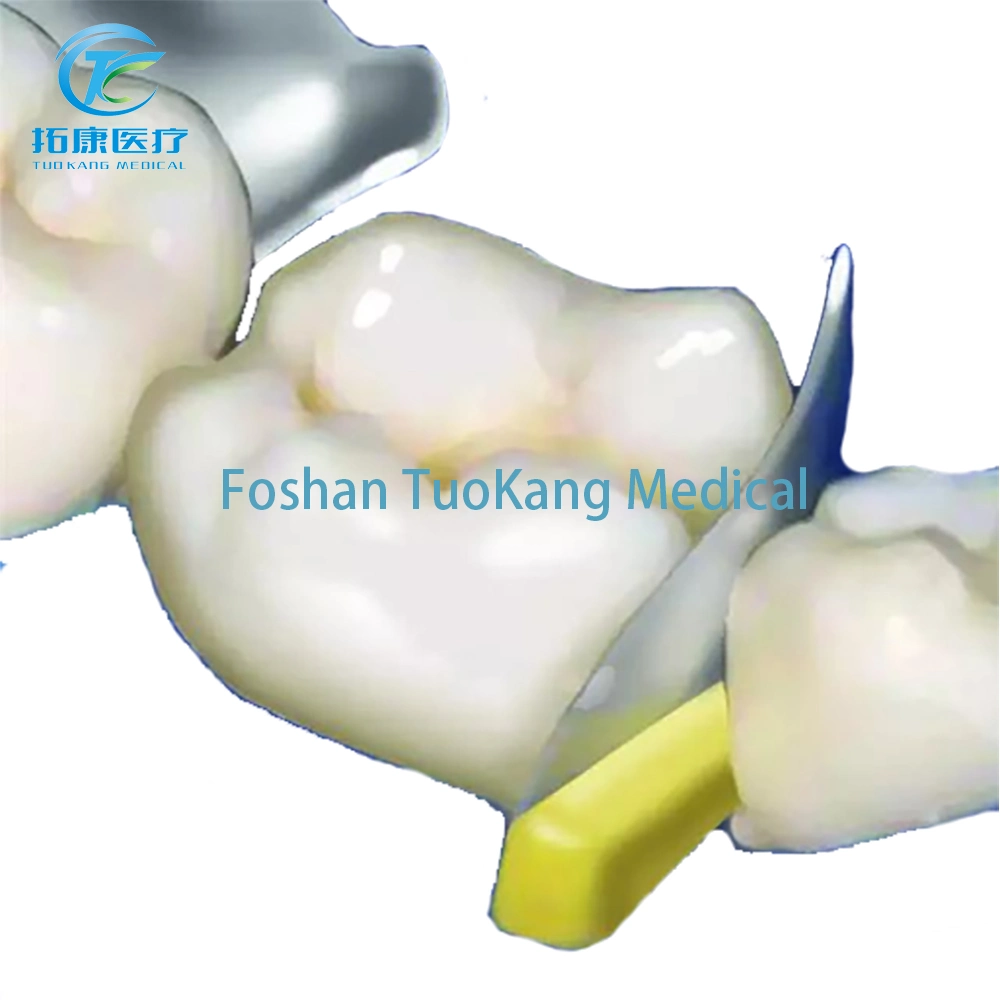 Produto quente Bandas de matriz Dentária Sistema transversal banda matriz matrizes com contornos contornada com preço baixo