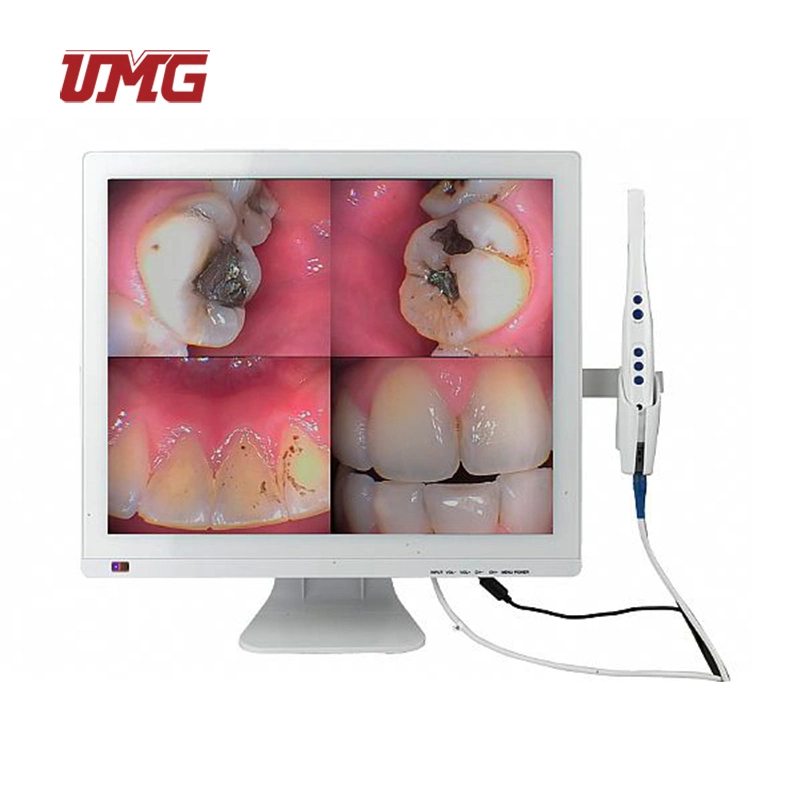 WiFi Dental Intra Oral Camera Image Digital System with Monitor