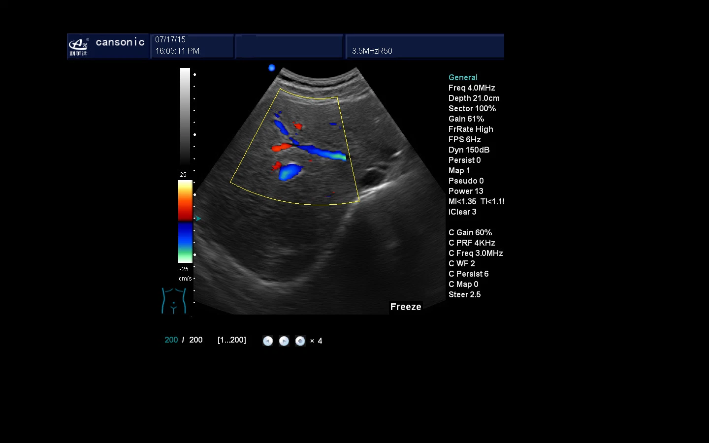 Color Doppler Ultrasound Medical Equipment