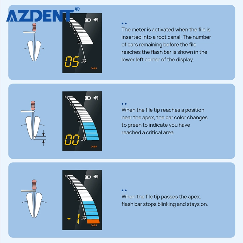 Dental Endo Apex Locator Root Canal Measurement Dentistry Tool for Dentist