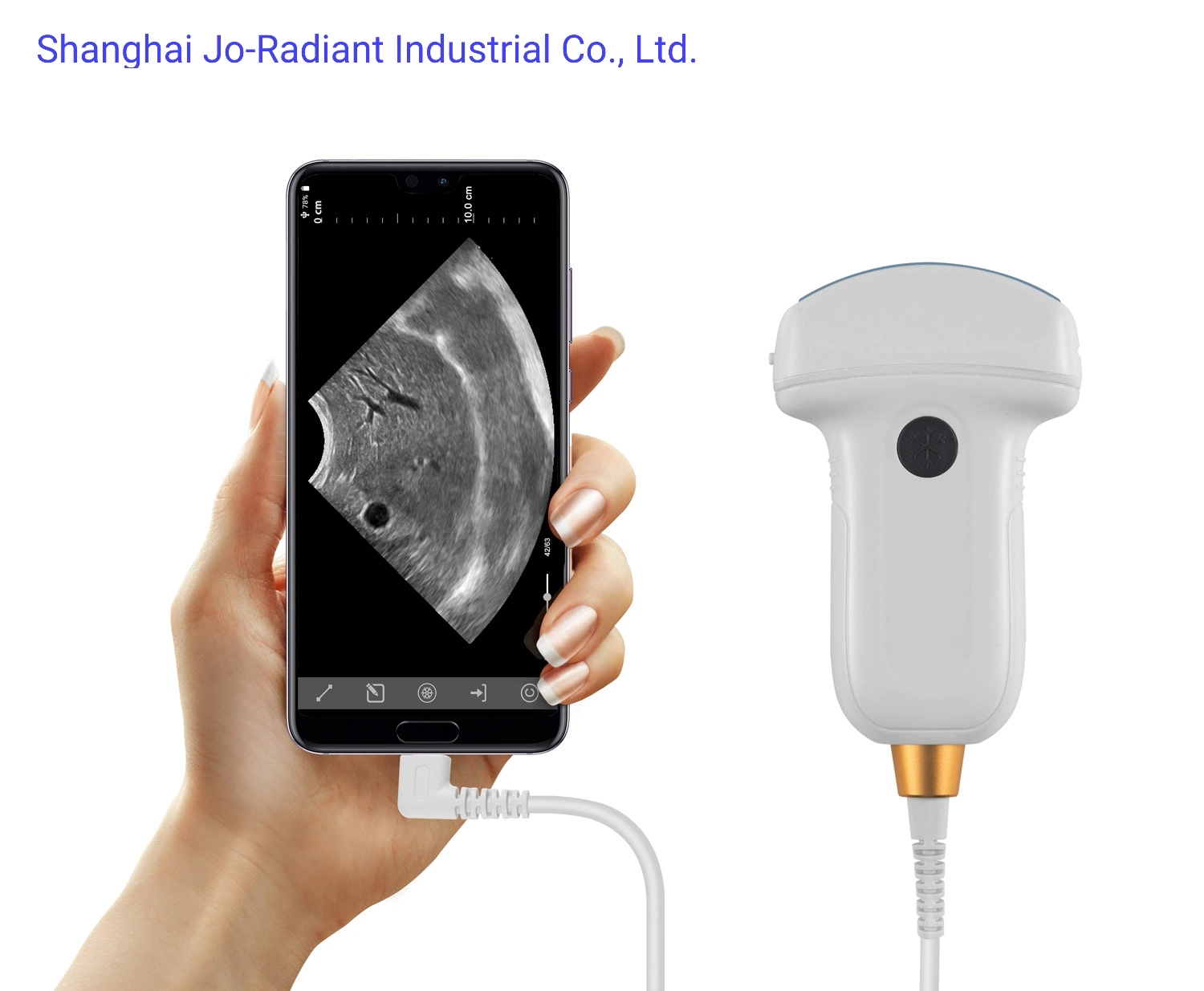 Full Digital Palm Ultraschall-Diagnostischen Ultraschall-Scanner