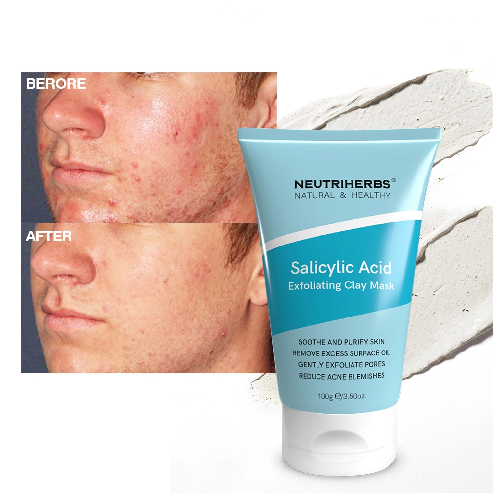 Factory Wholesale/Supplier Gently Cleanses Horny Skin Salicylic Acid Exfoliating Clay Mask