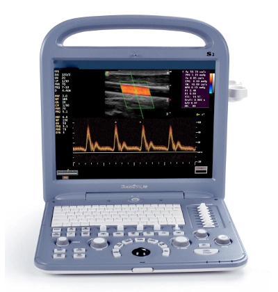 Low Price Portable Ultrasound Machine, Mini Laptop Ultrasound Scanner